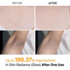 Revitalize Your Skin with Dr. Melaxin Peel Shot - Exfoliating Spray with Kojic Acid & Turmeric for Smooth, Even-Toned Skin - 6.76 Fl.Oz Korean Body Scrub for KP Bumps & Dark Spots