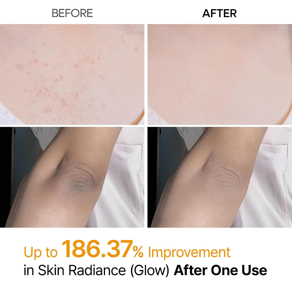 Revitalize Your Skin with Dr. Melaxin Peel Shot - Exfoliating Spray with Kojic Acid & Turmeric for Smooth, Even-Toned Skin - 6.76 Fl.Oz Korean Body Scrub for KP Bumps & Dark Spots