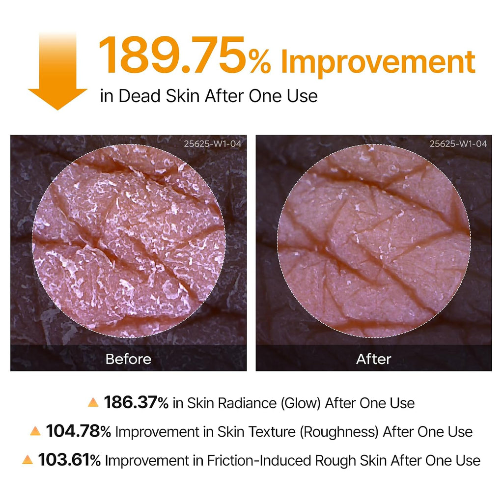 Revitalize Your Skin with Dr. Melaxin Peel Shot - Exfoliating Spray with Kojic Acid & Turmeric for Smooth, Even-Toned Skin - 6.76 Fl.Oz Korean Body Scrub for KP Bumps & Dark Spots