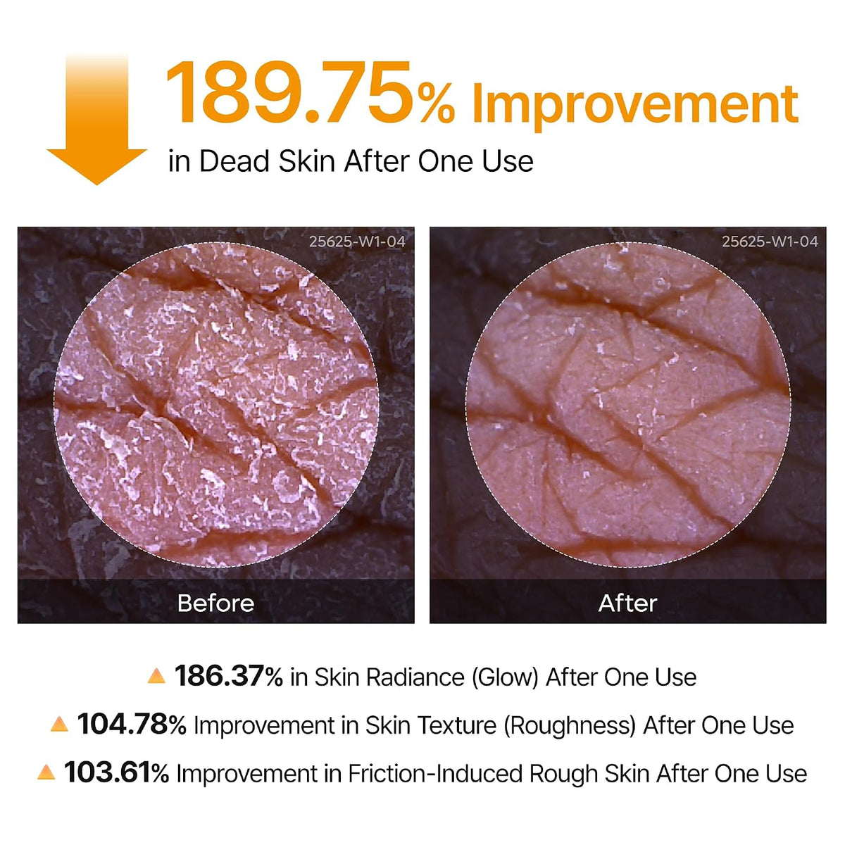 Revitalize Your Skin with Dr. Melaxin Peel Shot - Exfoliating Spray with Kojic Acid & Turmeric for Smooth, Even-Toned Skin - 6.76 Fl.Oz Korean Body Scrub for KP Bumps & Dark Spots