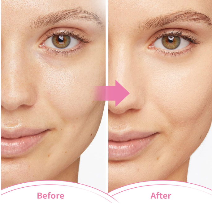 Cold Therapy Ice Face Mask