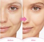 Cold Therapy Ice Face Mask